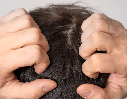 Scalp and hair assessment