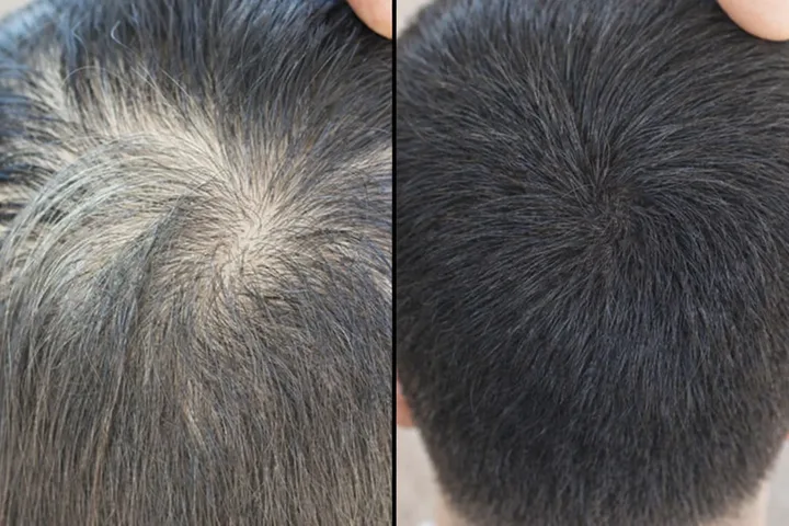 Diffuse Thinning